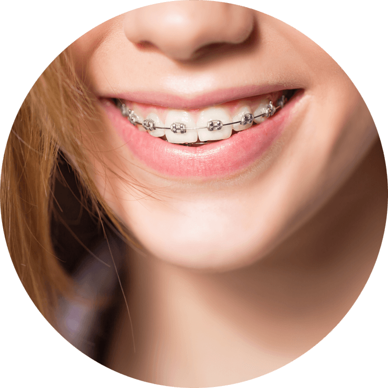 dental patient wearing braces